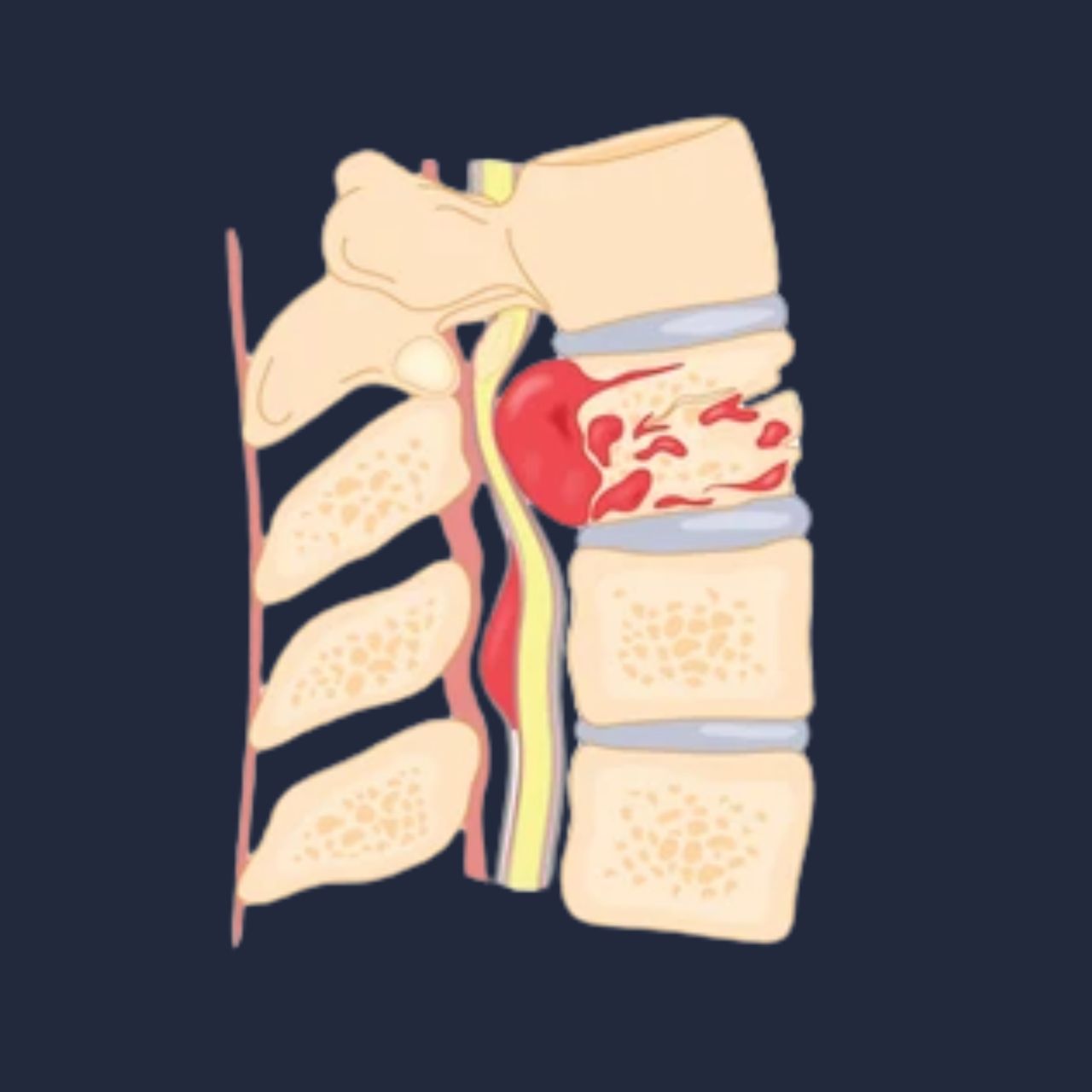 David Tafur Muñoz-2492