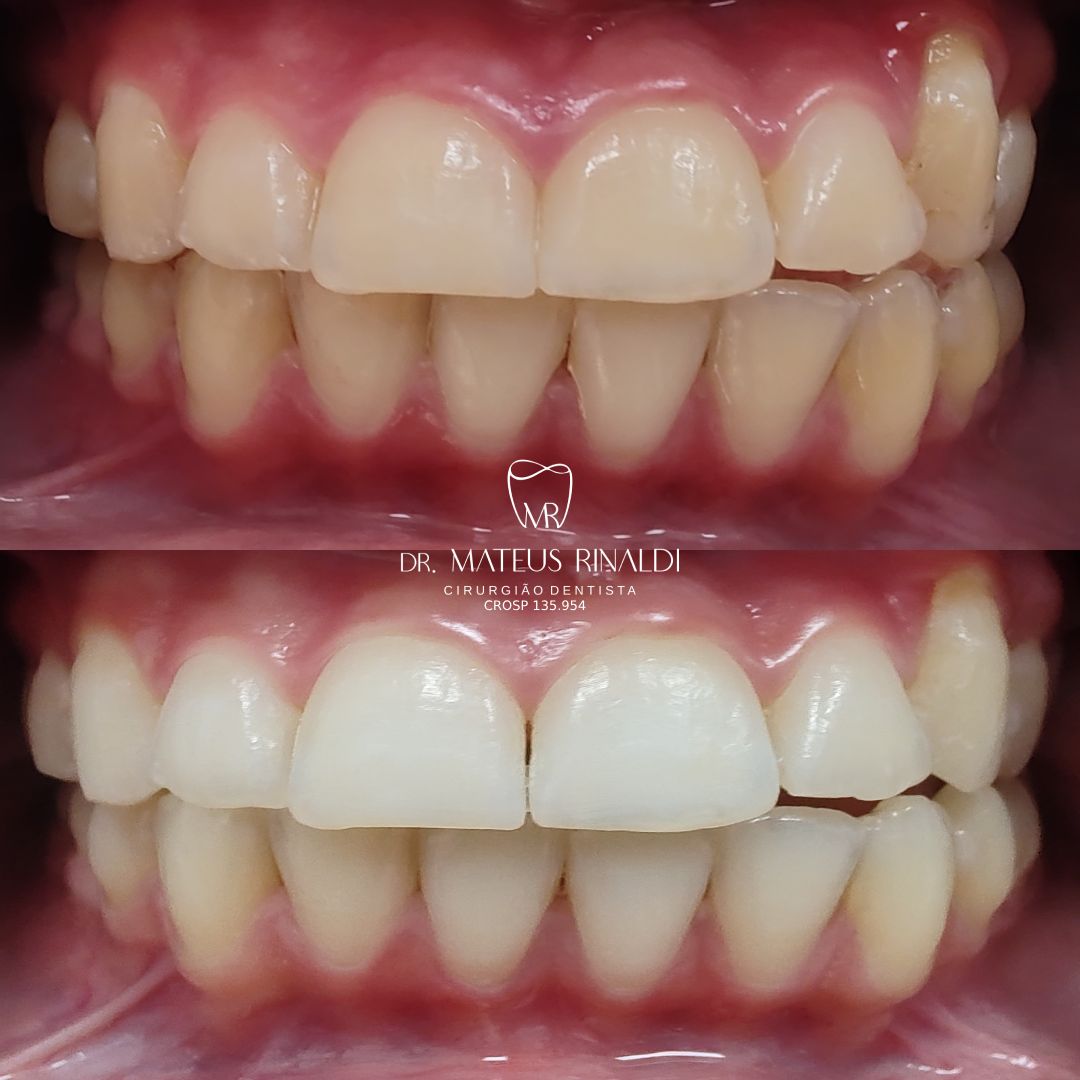 Mateus Rinaldi Lucio Martins-12