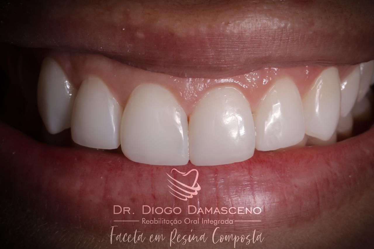 Diogo Damasceno-23