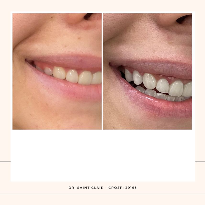 Saint Clair Barbosa Netto-7