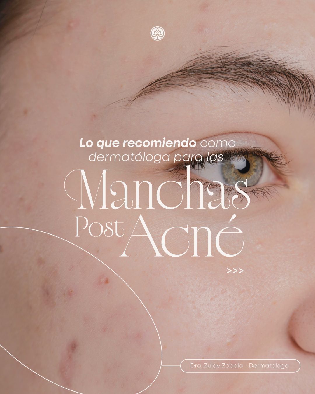 Zulay Angelica Zabala Suarez-17