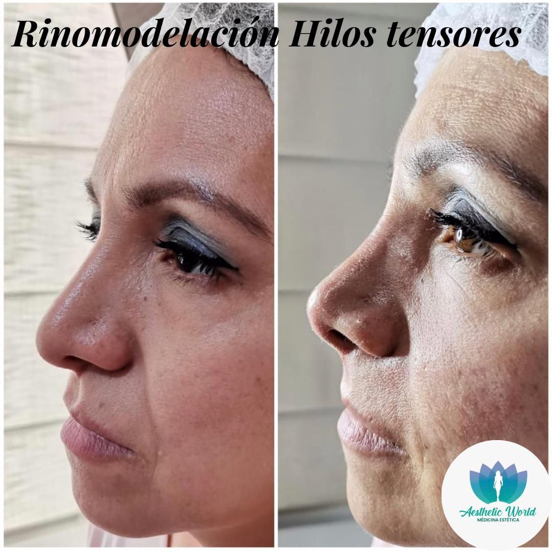 Jhonatan Oyola Farfán-26