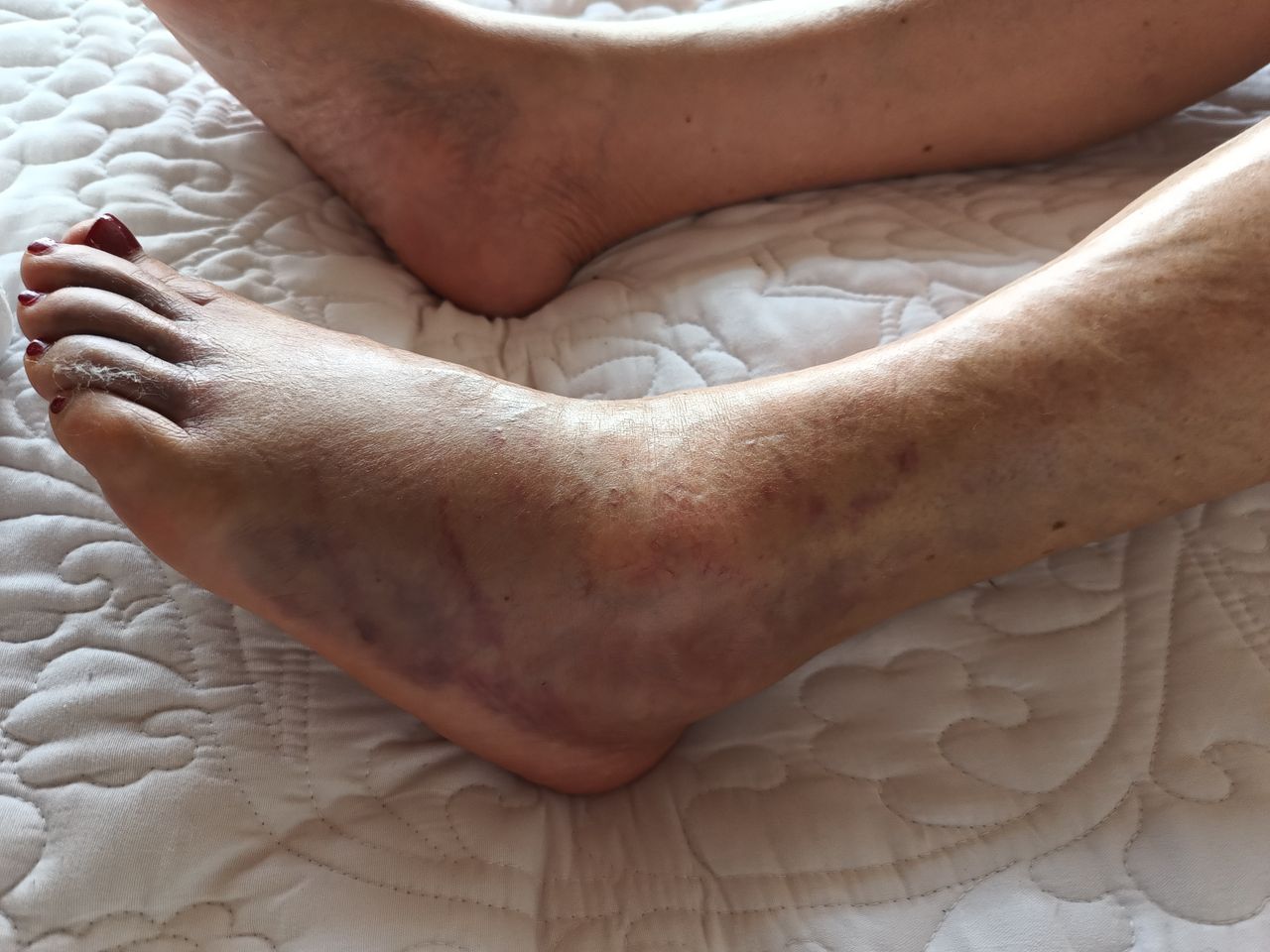 Luz Angela Murcia Camargo-6