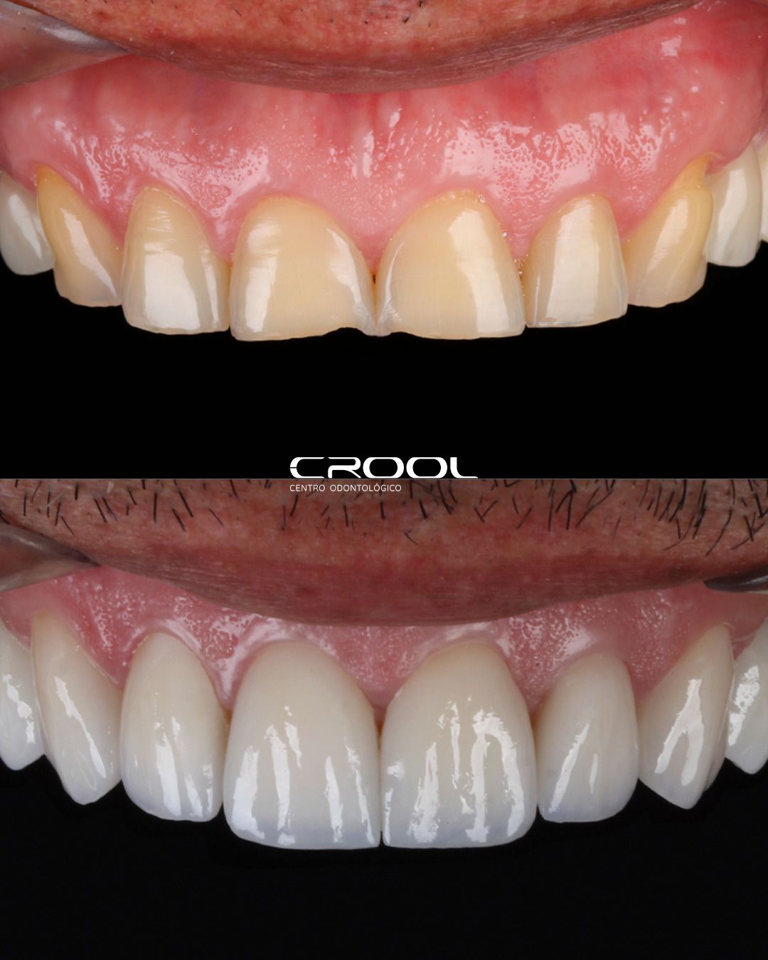 Frederico  Coelho-14