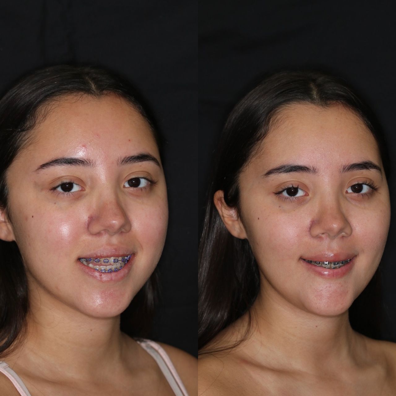 Bruno Nifossi Prado-24