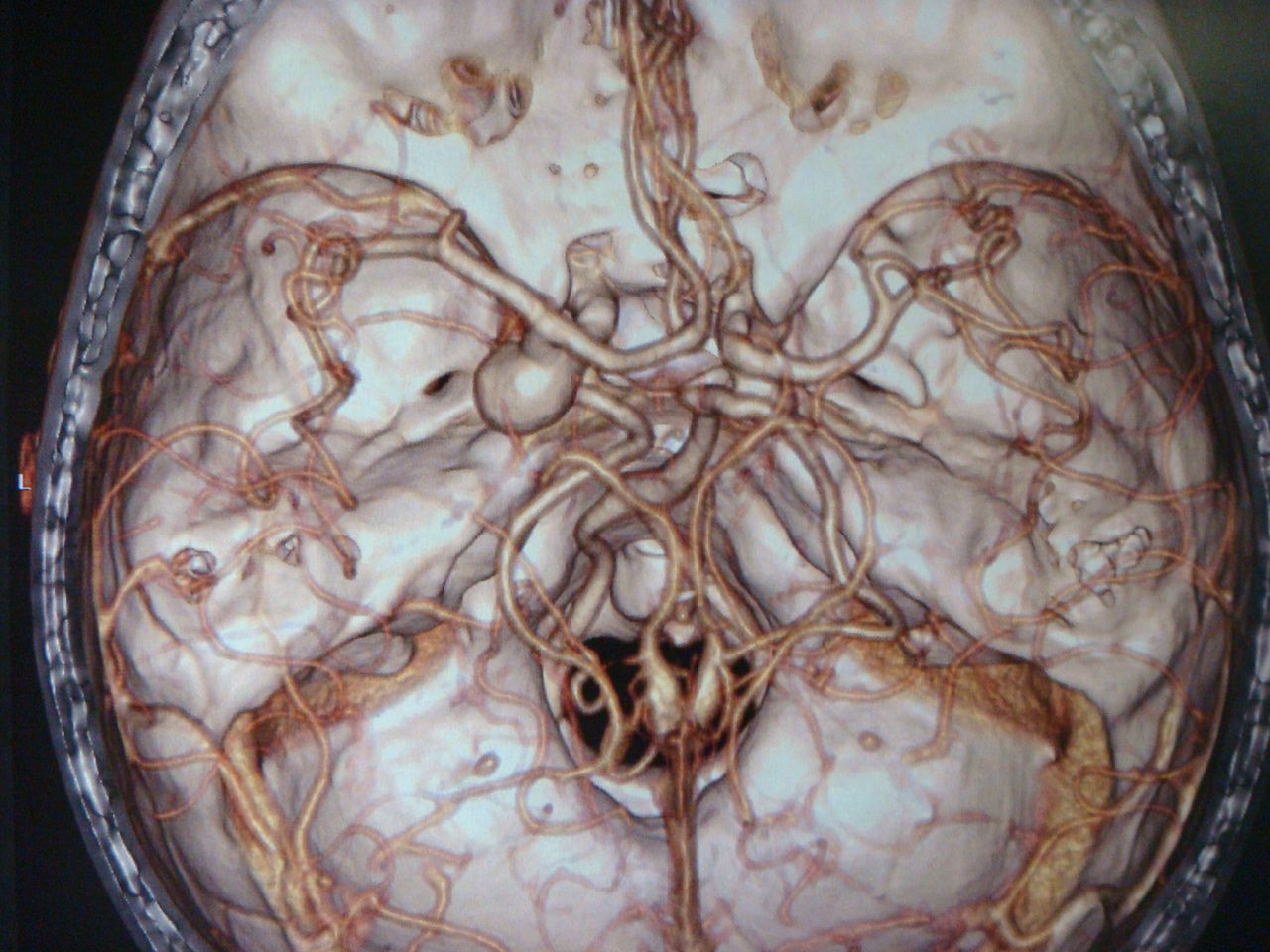 Leonardo Conrado Silva Lima-5