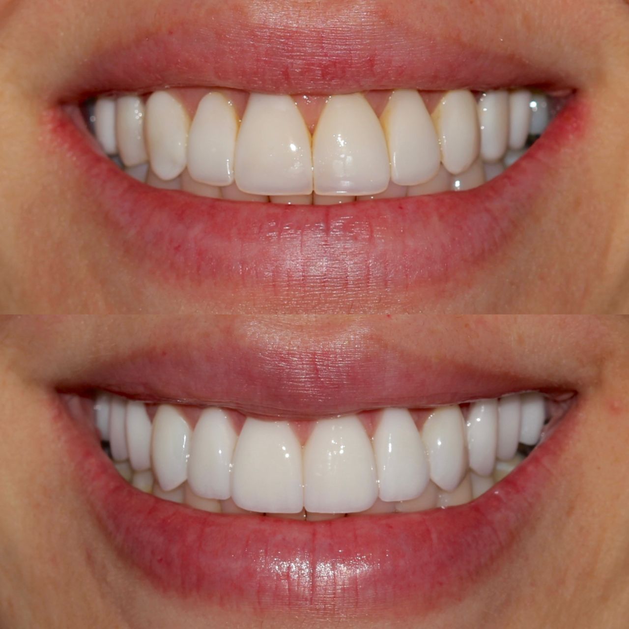 Caroline Benedeti-10