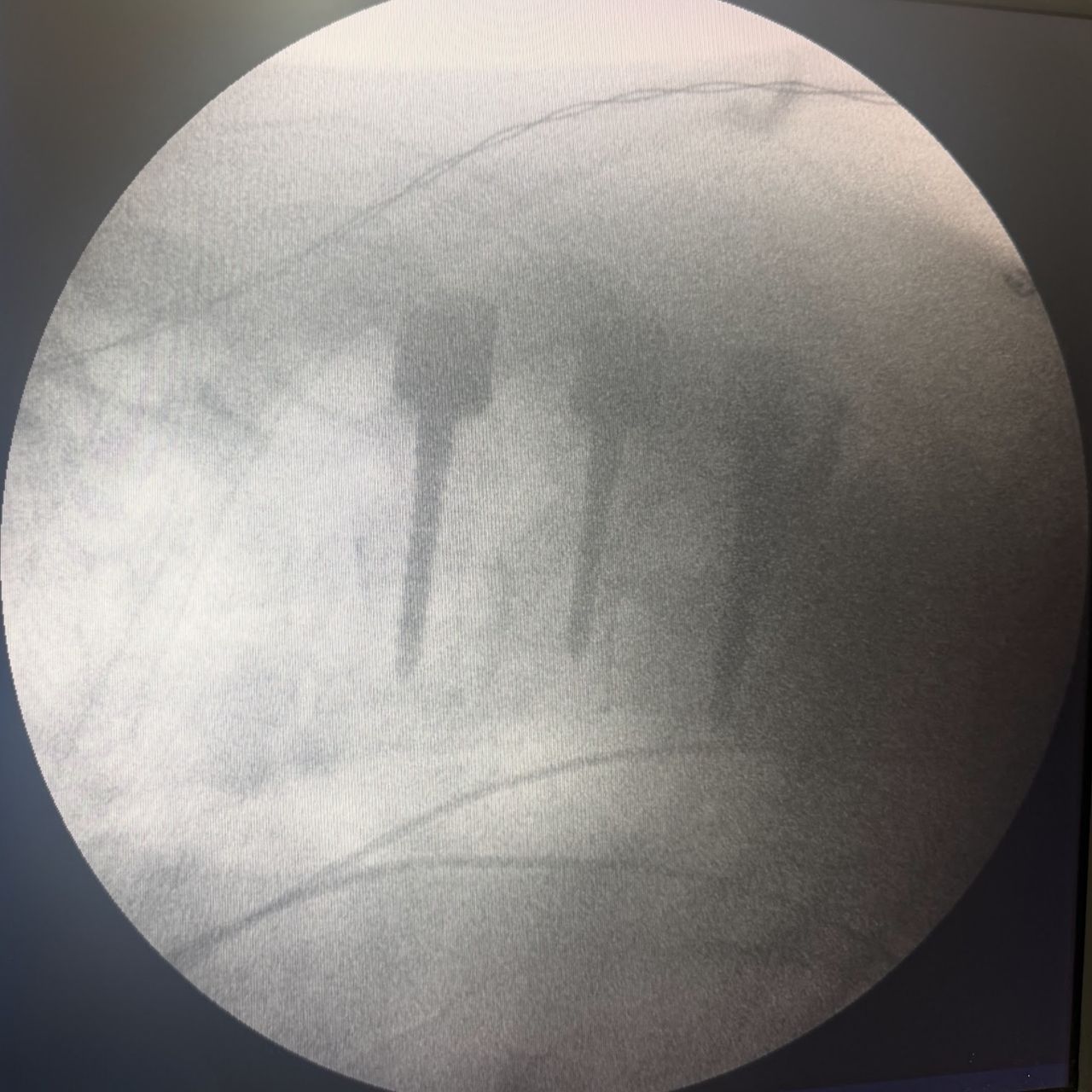 David Tafur Muñoz-2490