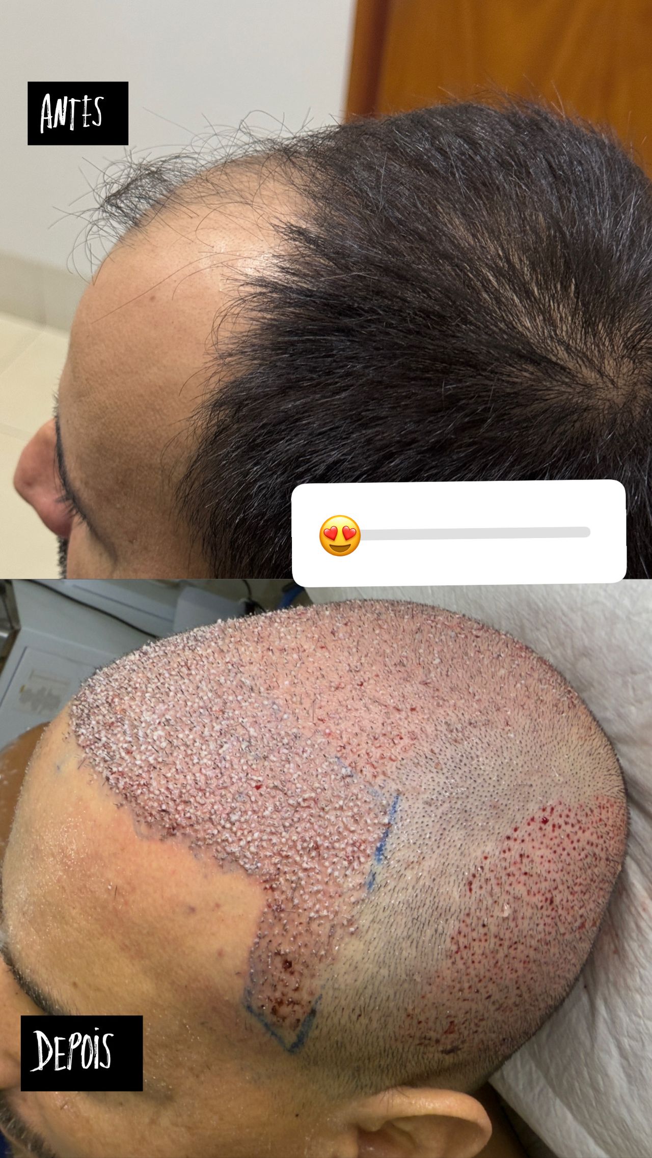 Johnny Biller  Dias Freitas -2