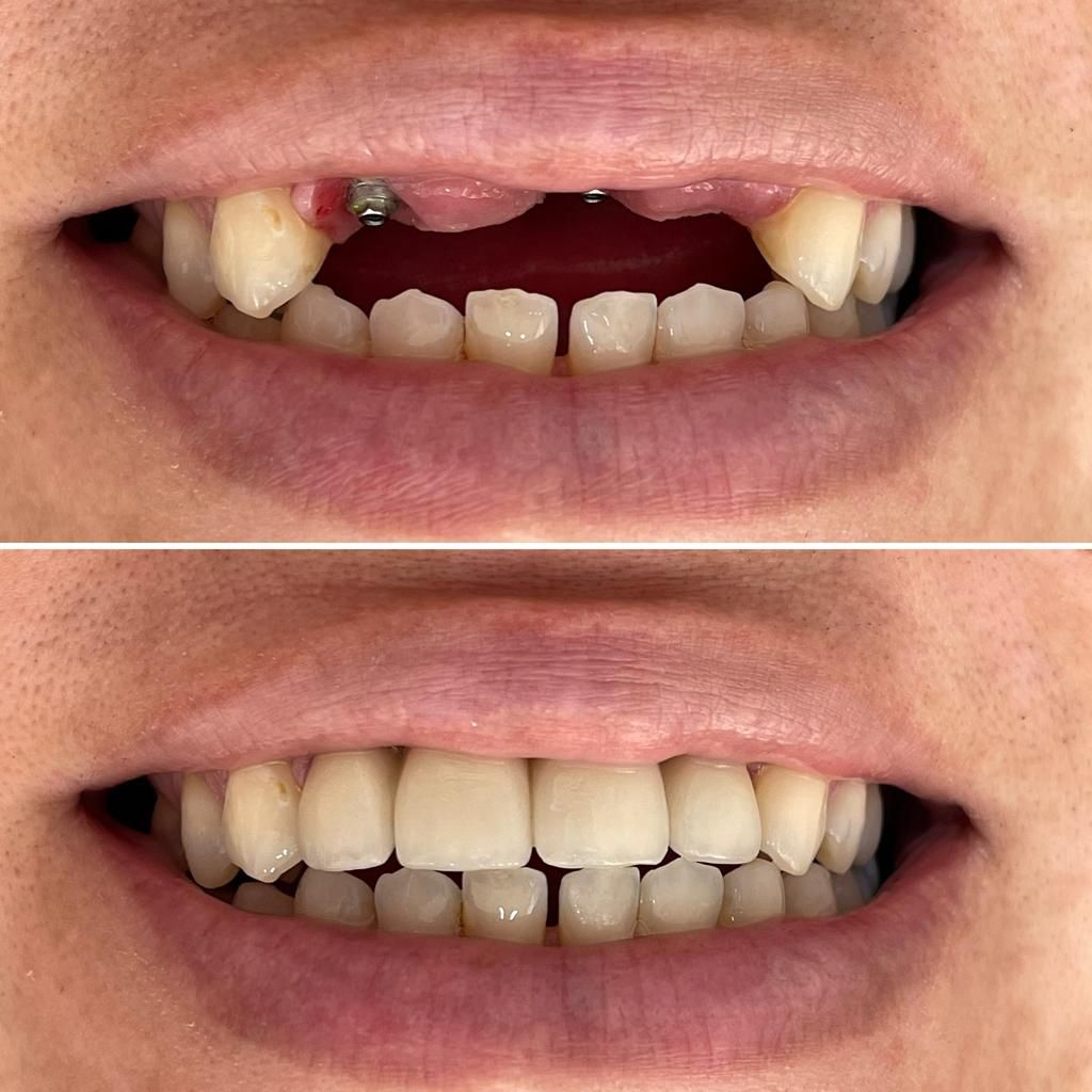 Fernanda Archipéva-17