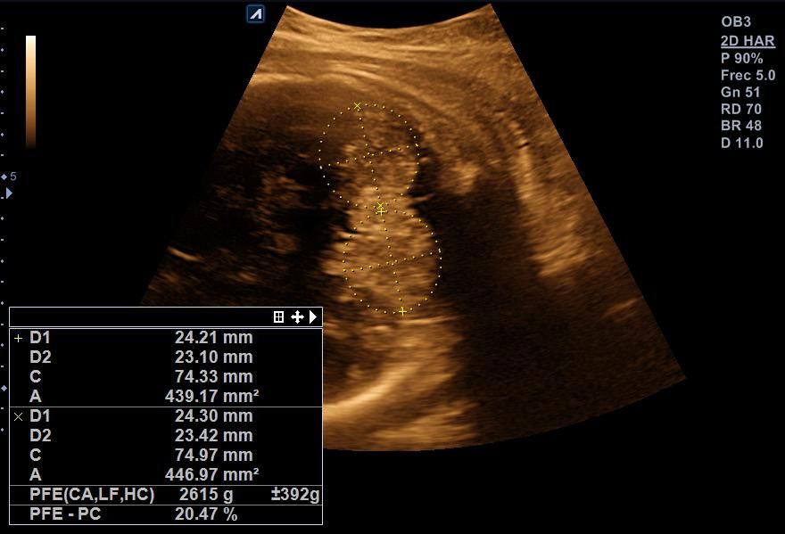 Benjamín Villarroel Castillo-6