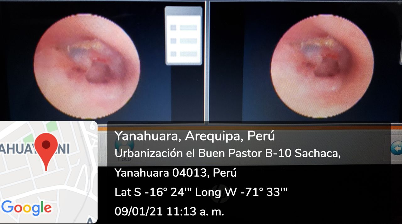 Ronald Ruben Sillo Cari-5