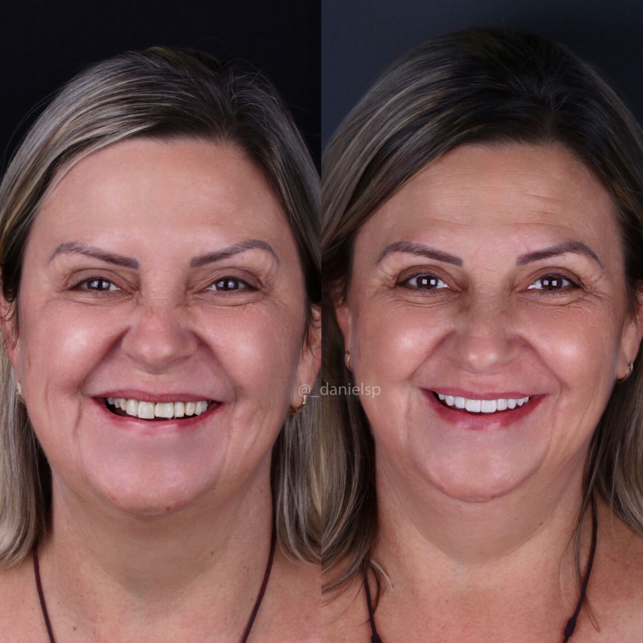 Daniel De Souza Pereira-10