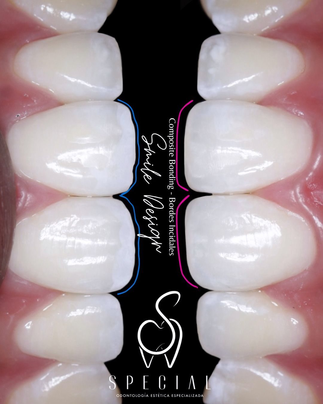 Miguel Dario Charfuelan I.-0