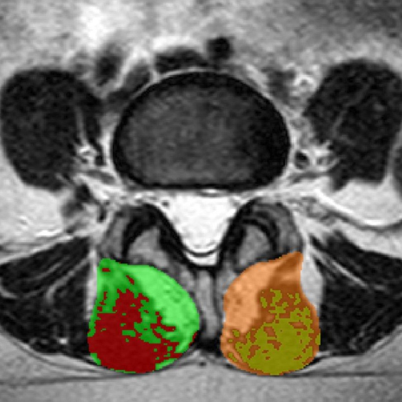 David Tafur Muñoz-1811