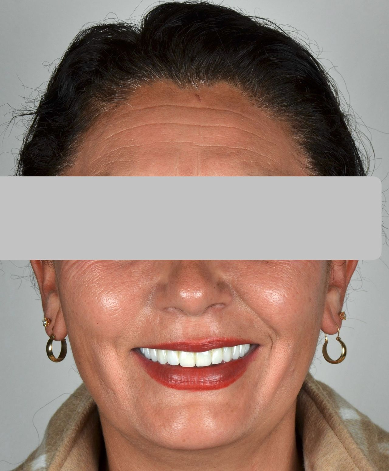 Luciano Varas Salinas-25