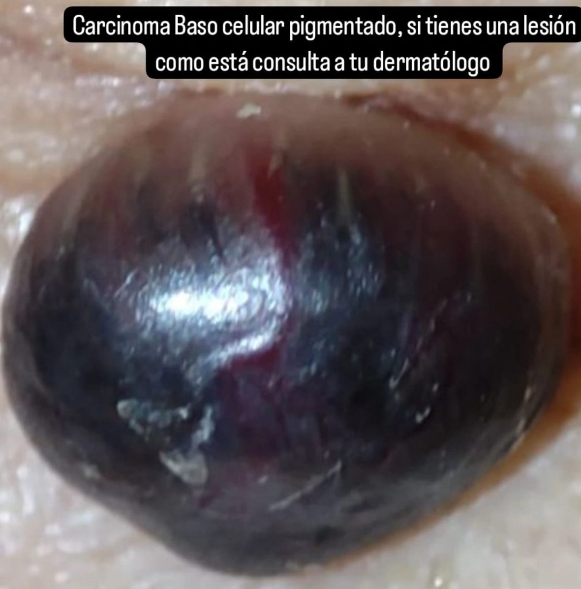 Marcos Ortiz Perez-12