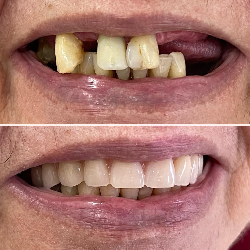 Fernanda Archipéva-14