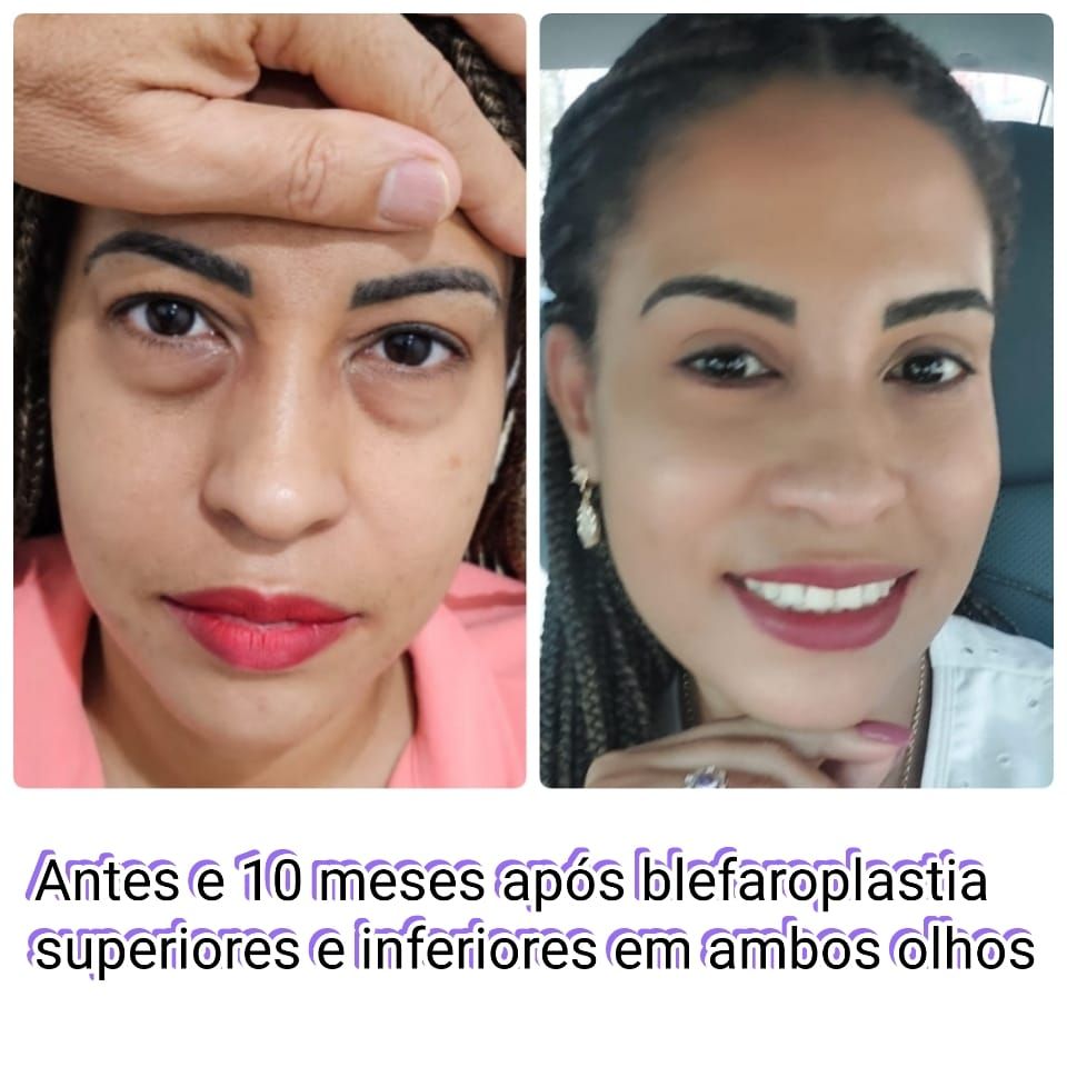 Ingrid  Lustosa Madeira Neves-28