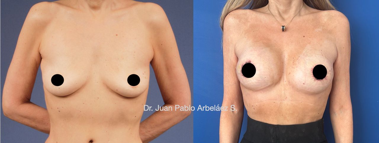 Juan Pablo Arbeláez Sierra-27