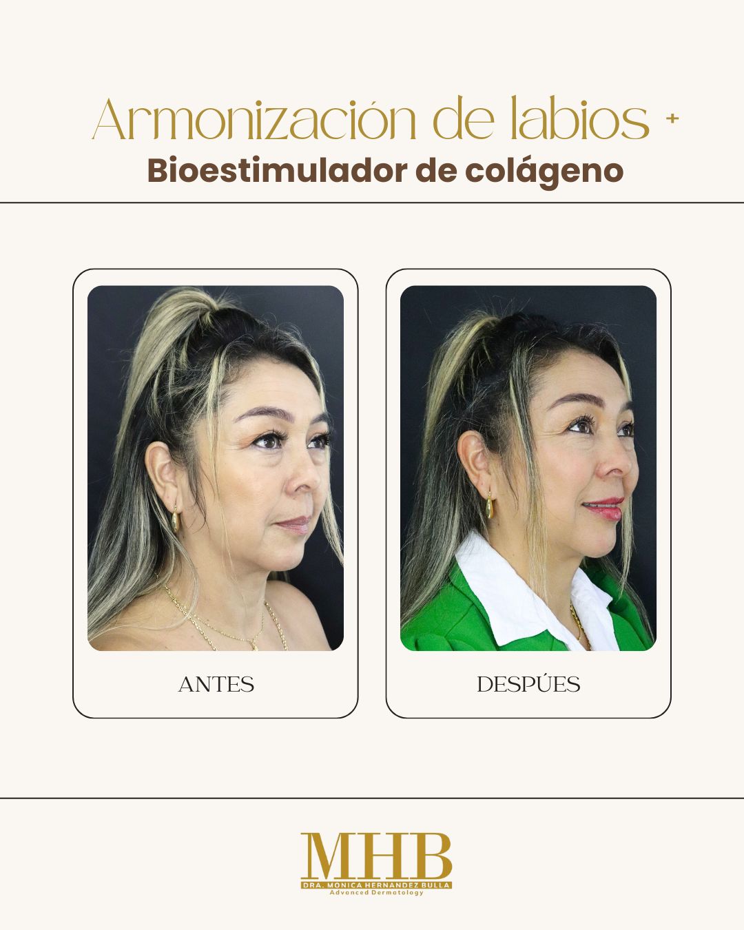 Mónica Hernandez Bulla-42