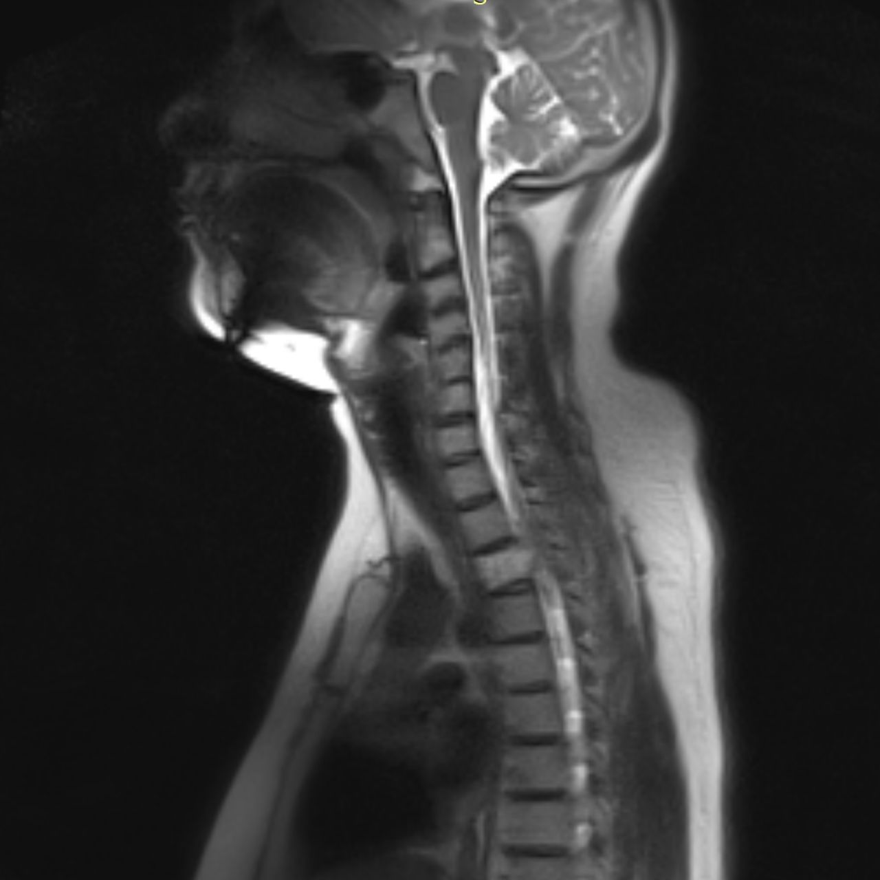 David Tafur Muñoz-2494