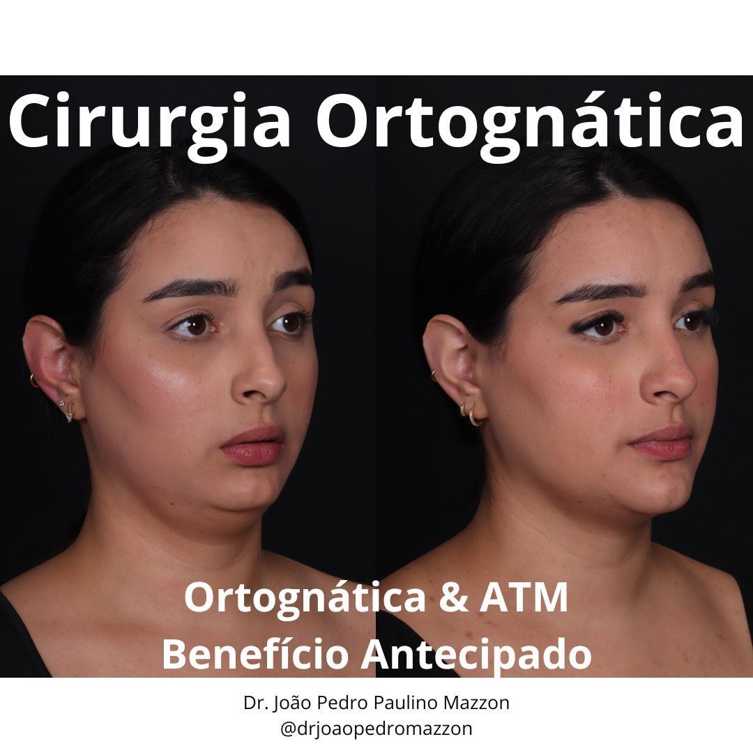 João Pedro Paulino Mazzon-1