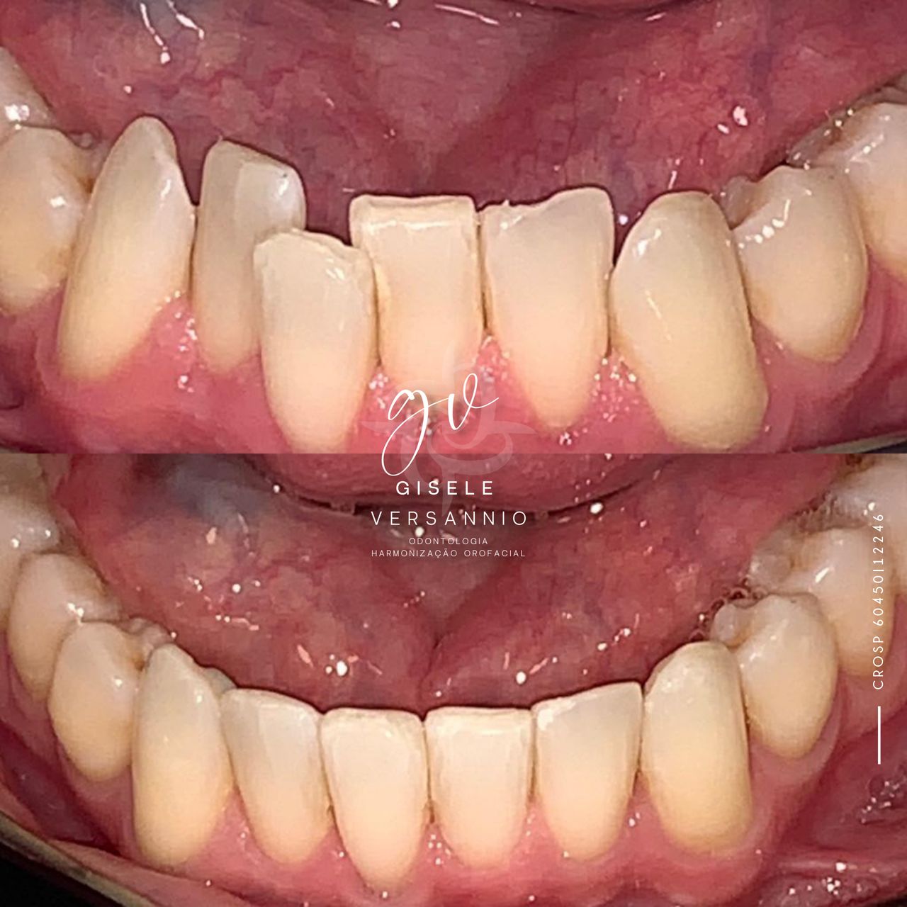 Gisele De Carvalho Versannio-10