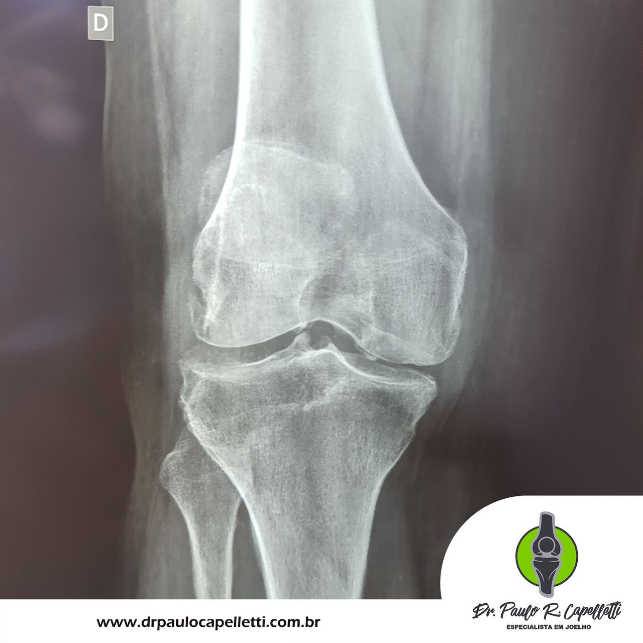 Paulo Roberto Capelletti-15