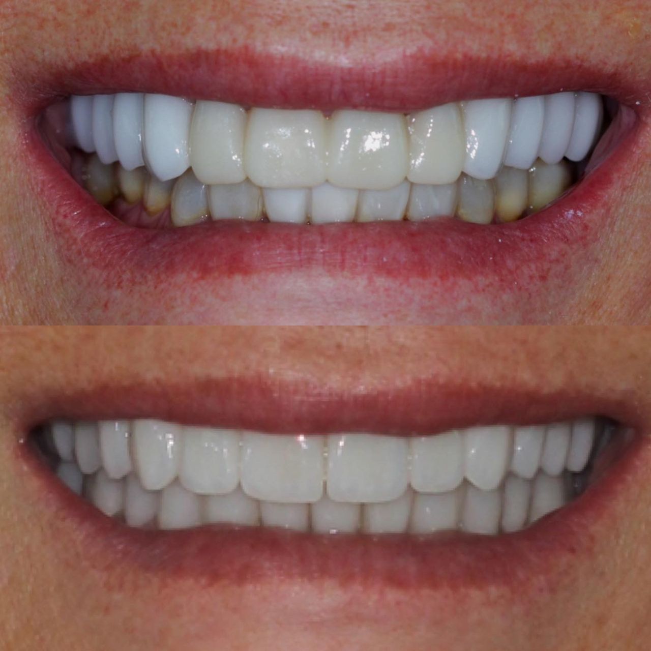 Caroline Benedeti-38