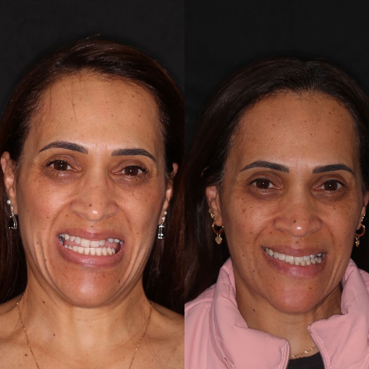 Bruno Nifossi Prado-16