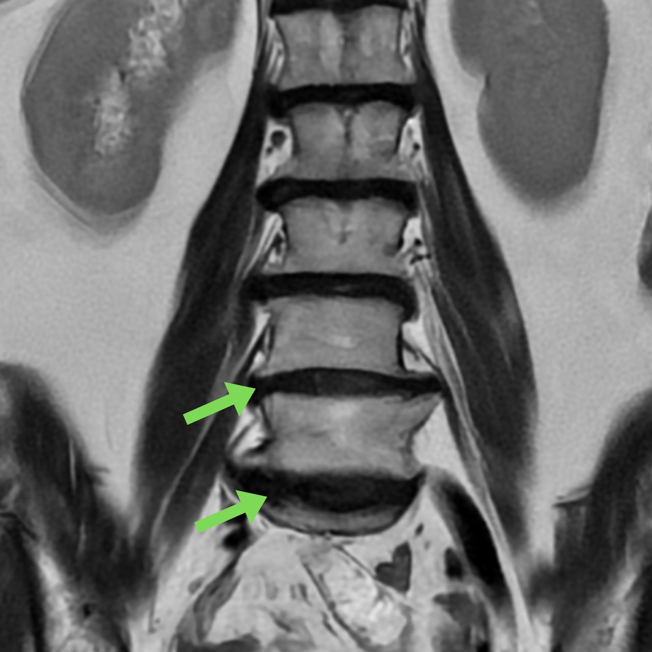 David Tafur Muñoz-1507
