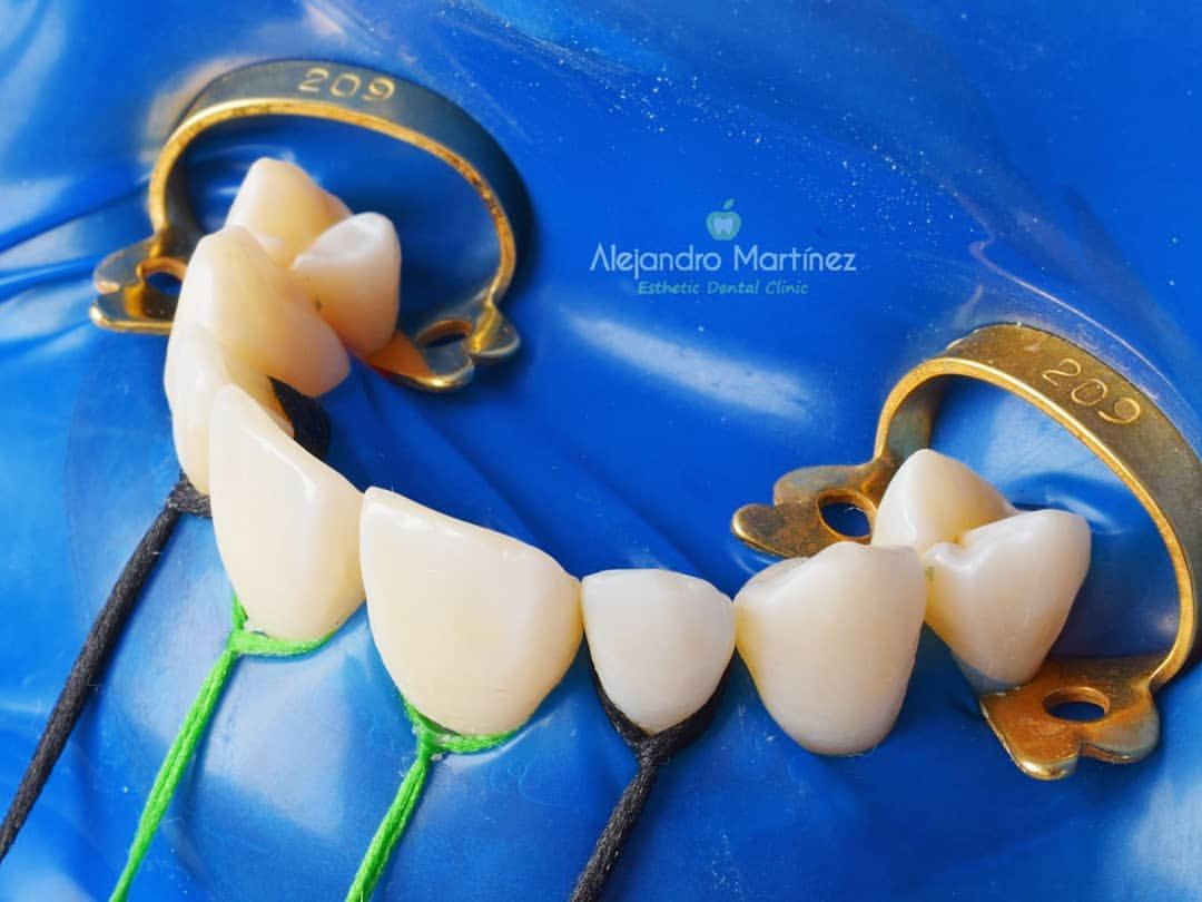 Alejandro Martinez-15