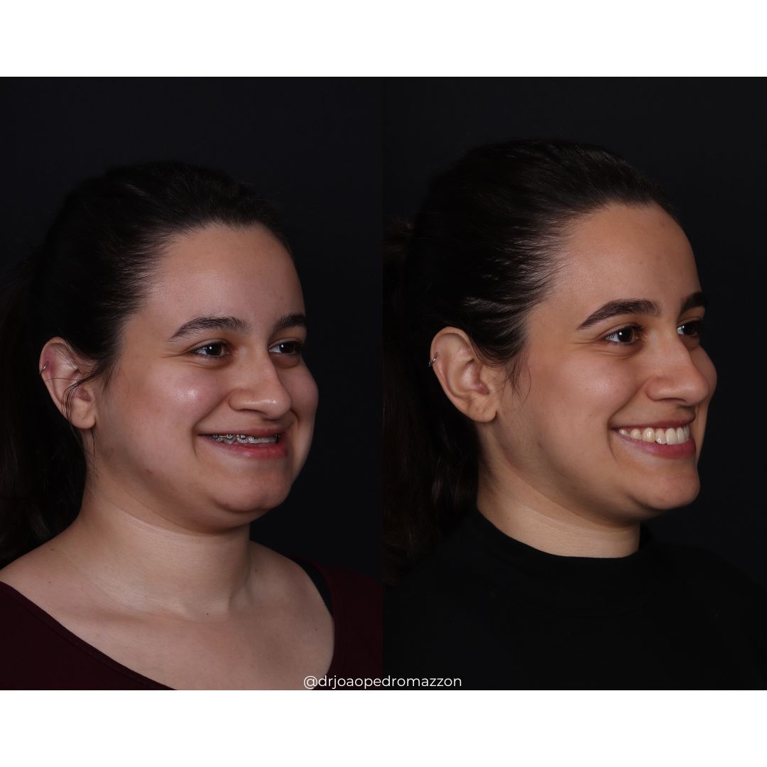 João Pedro Paulino Mazzon-64