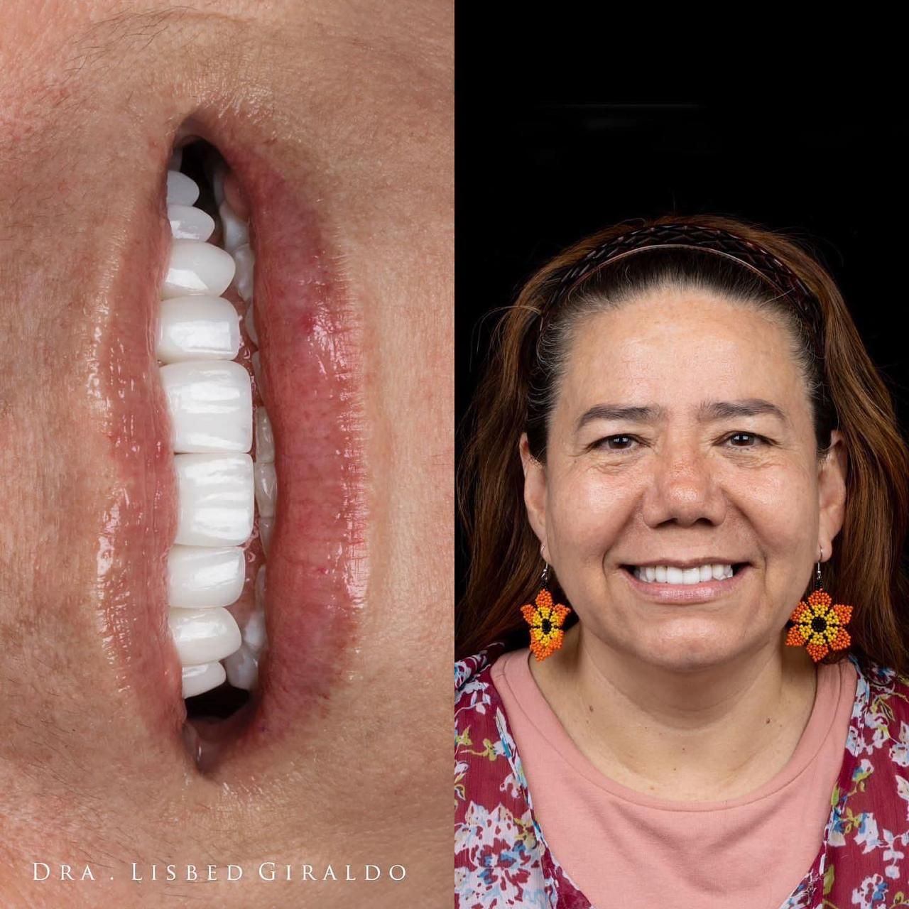 Lisbed Giraldo Olarte-31