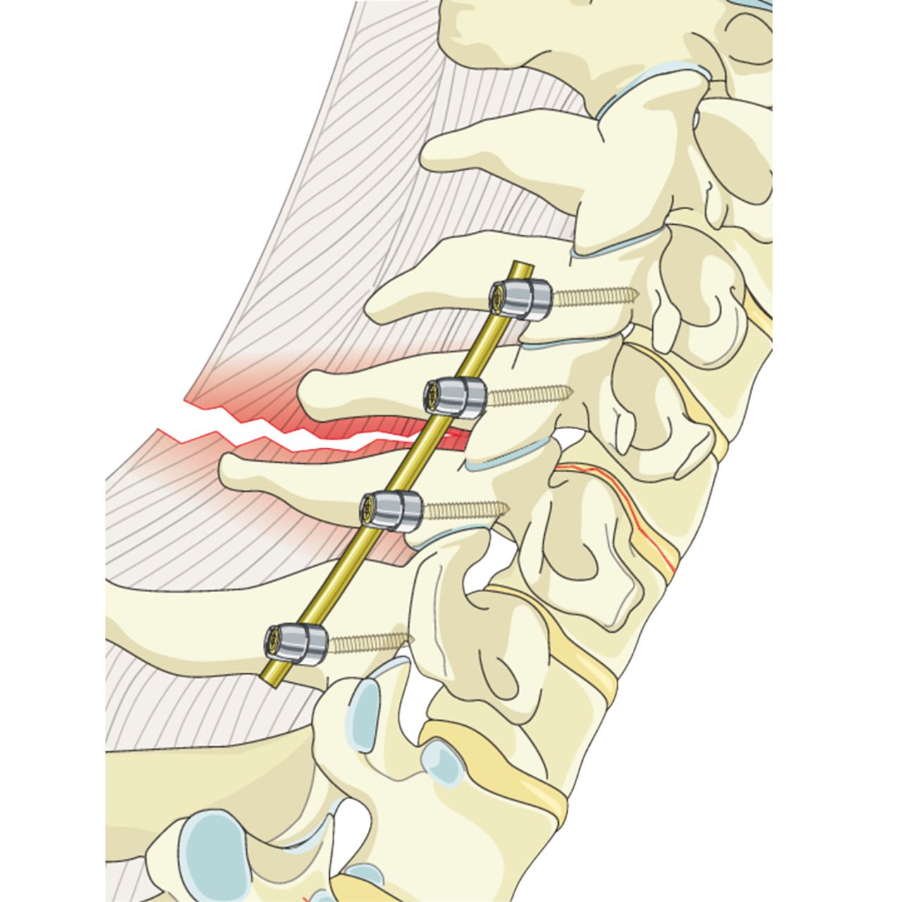 David Tafur Muñoz-1362