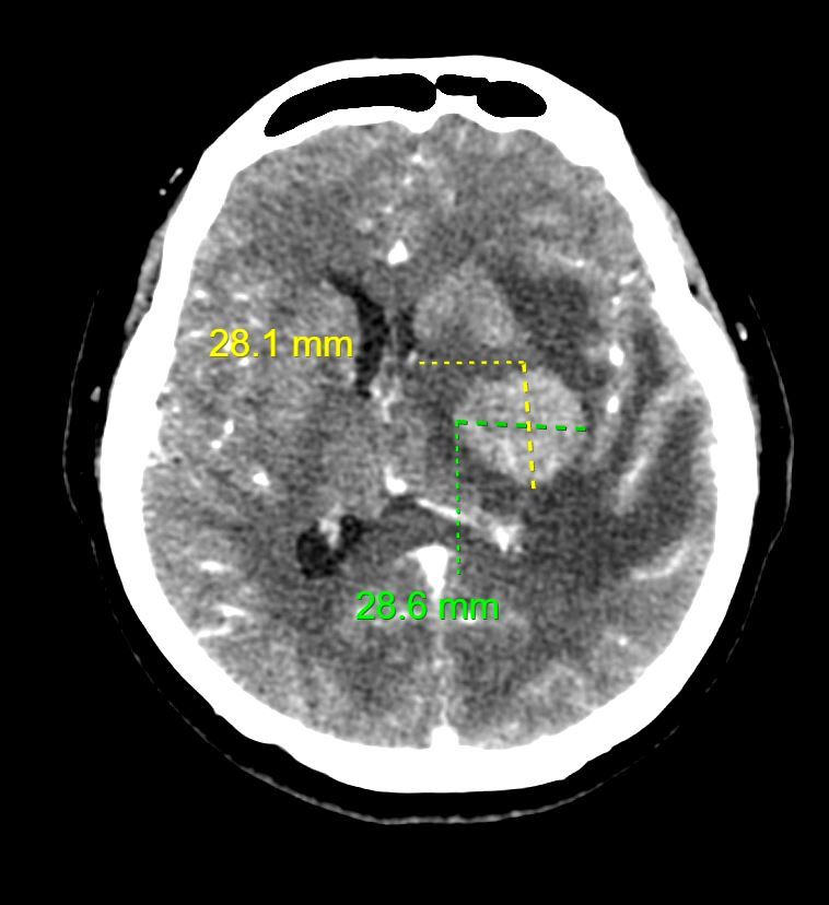 David Tafur Muñoz-1071