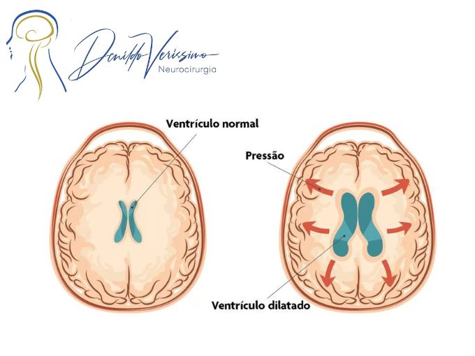 Denildo Veríssimo-23