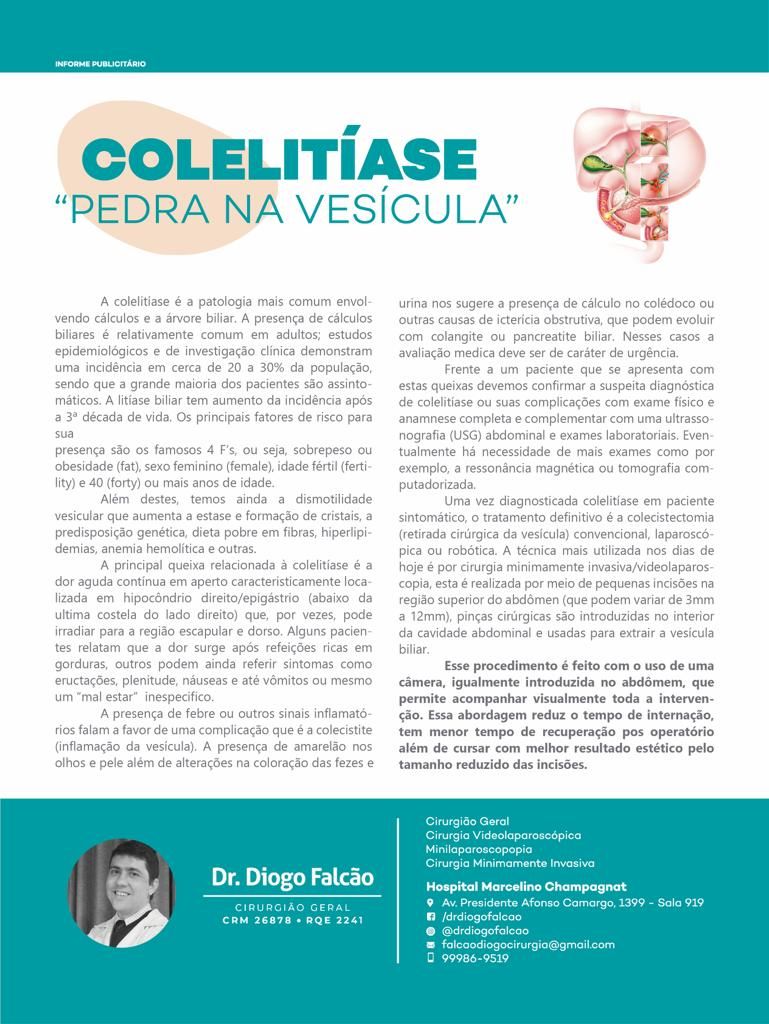 Diogo Parente Falcão-24