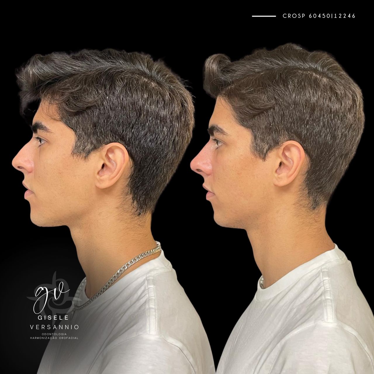 Gisele De Carvalho Versannio-36