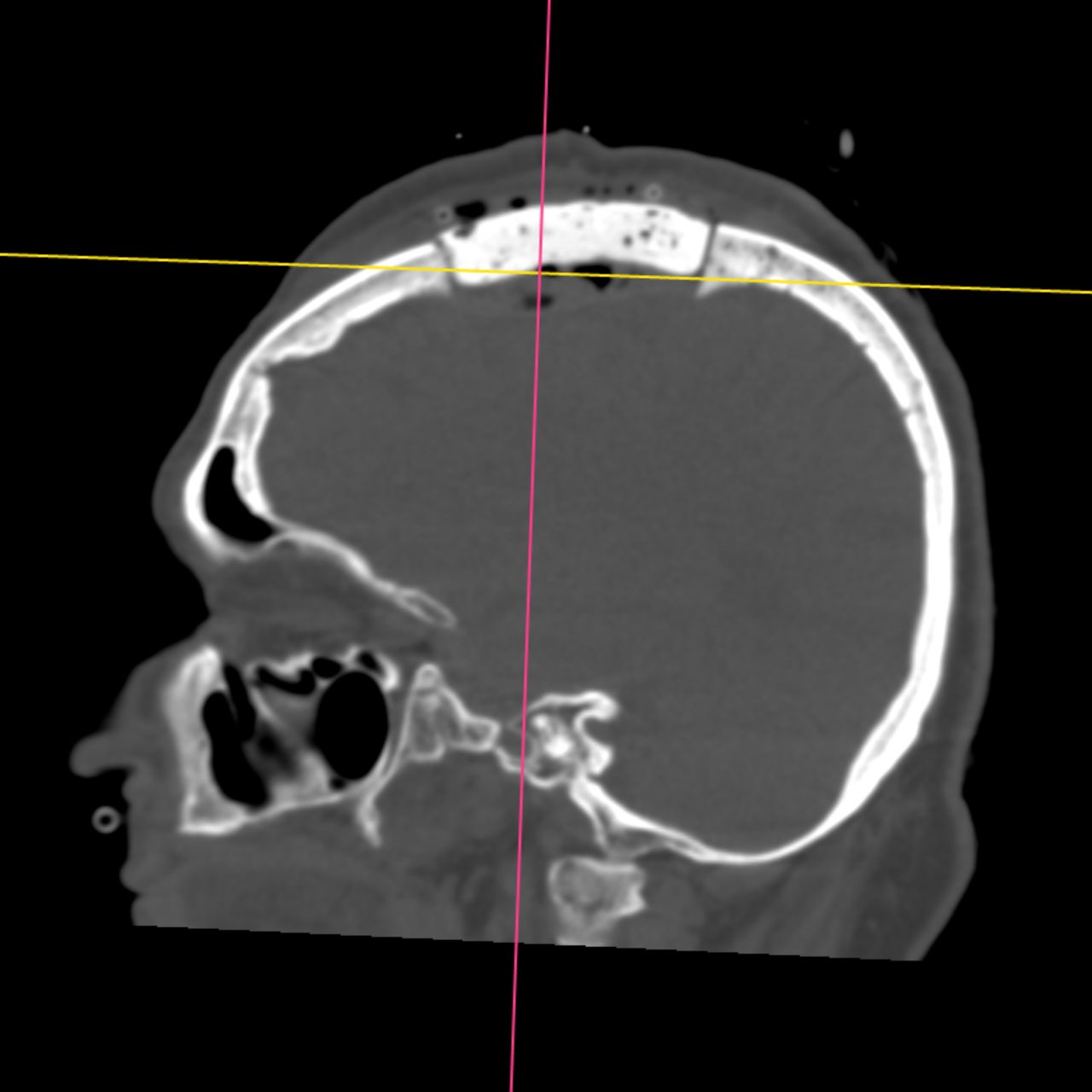 David Tafur Muñoz-2220