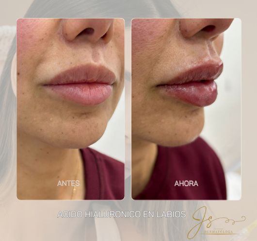 Jasiel Sarai Salas Gomez-2