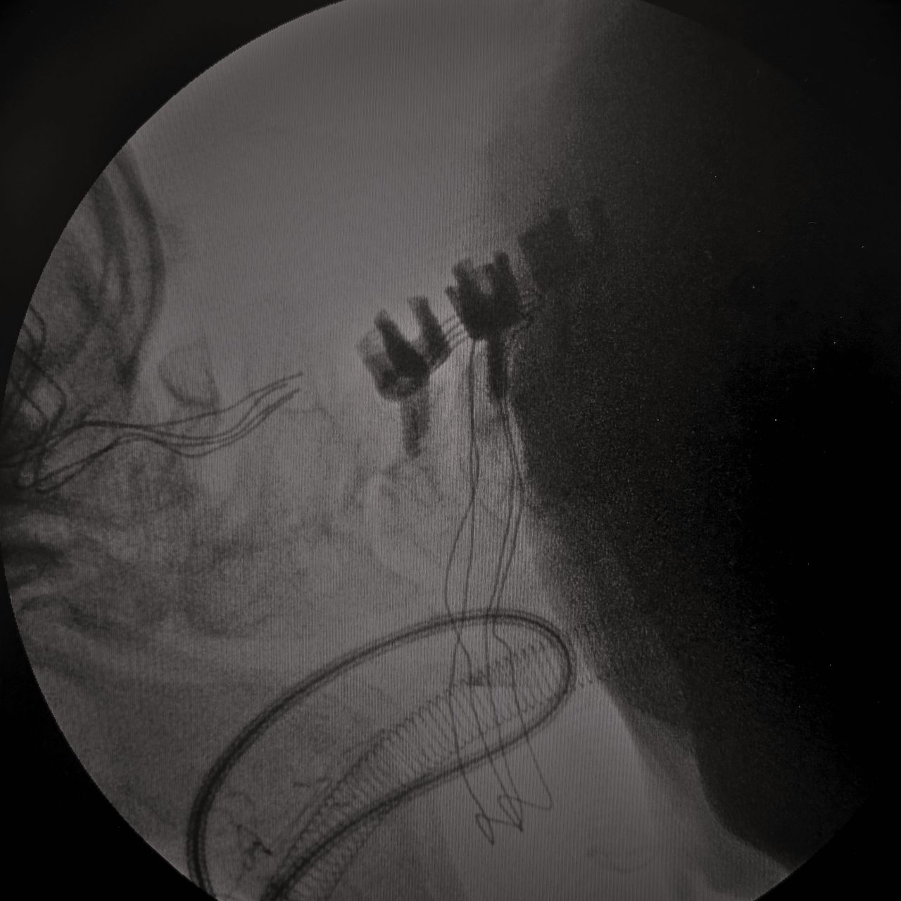 David Tafur Muñoz-2335