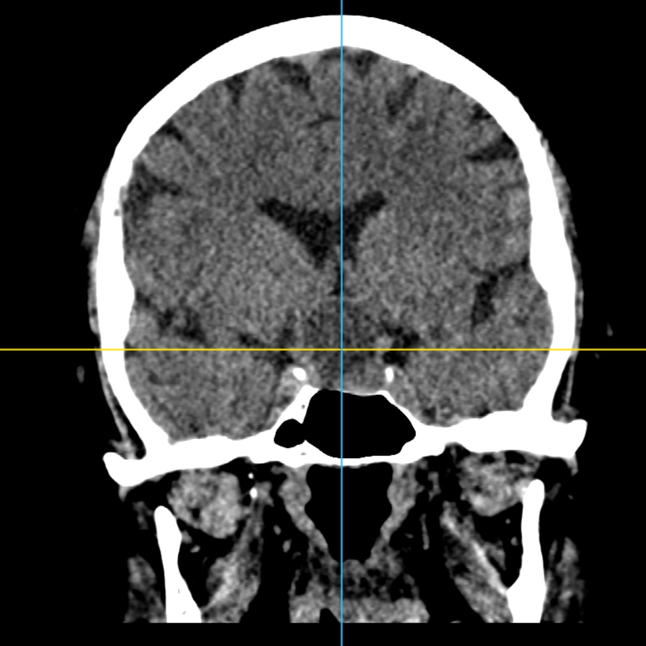 David Tafur Muñoz-1843