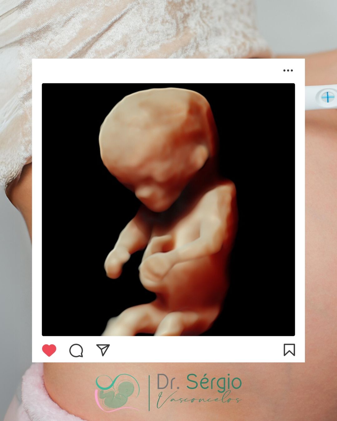 Sérgio De Abreu Vasconcelos Neto-7