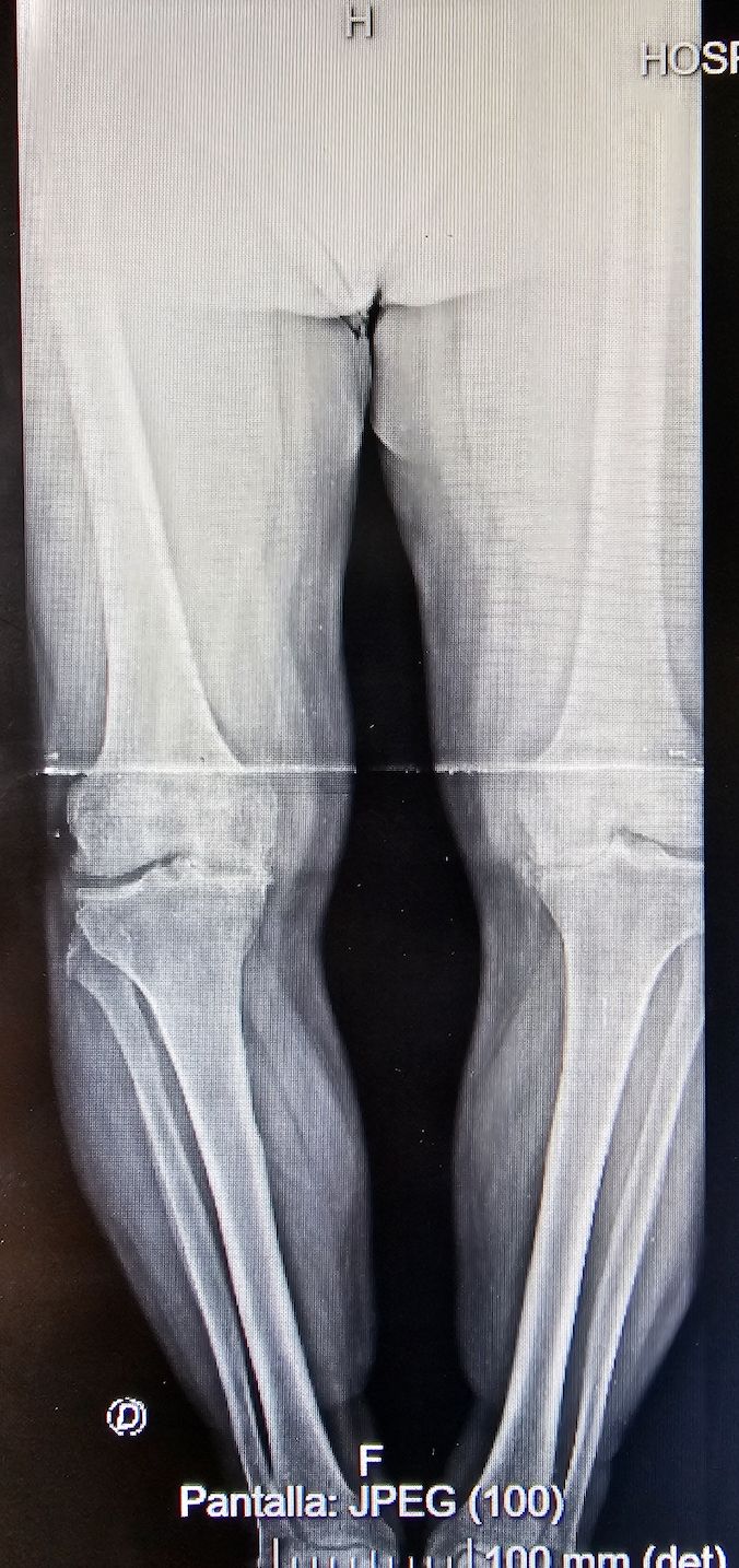 Jose Antonio Cordero Zirotti-3