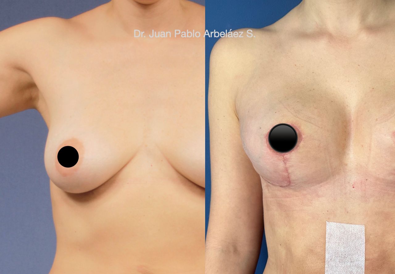 Juan Pablo Arbeláez Sierra-8