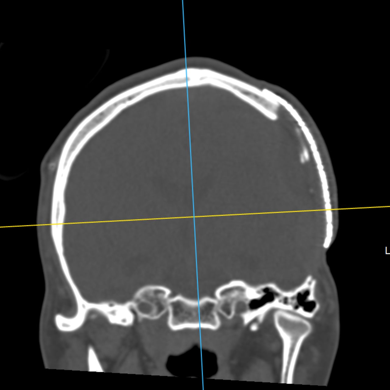 David Tafur Muñoz-2217