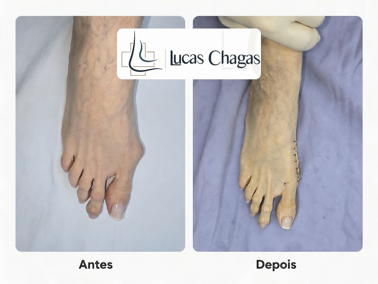 Lucas Chagas Gadelha-5