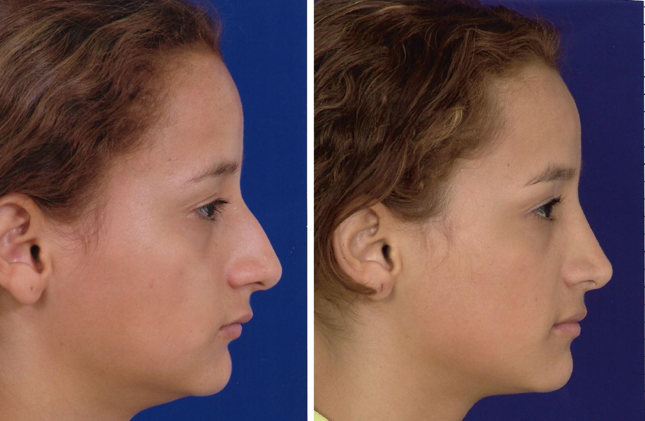 Jorge A Holguin Ruiz-13